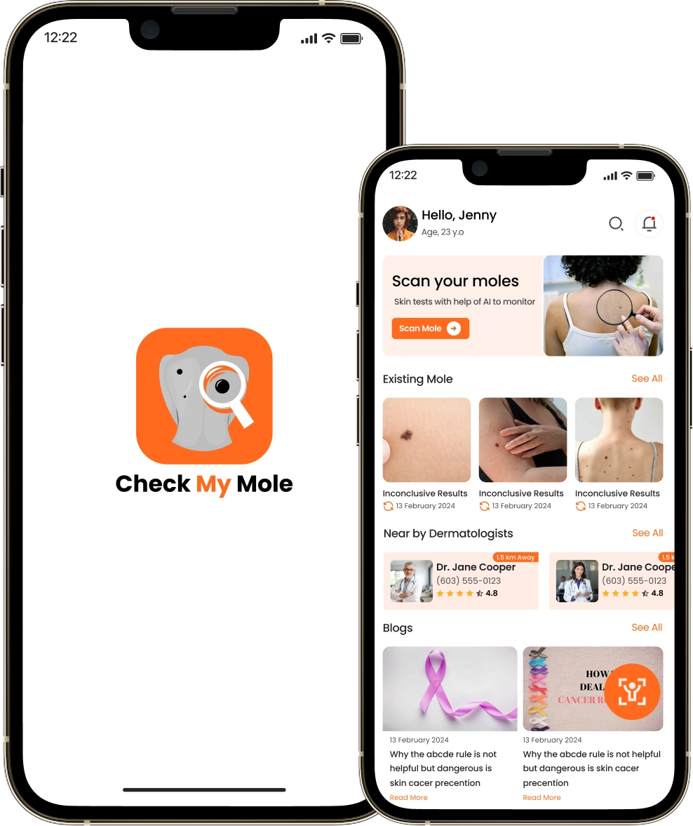 Check My Mole app screen