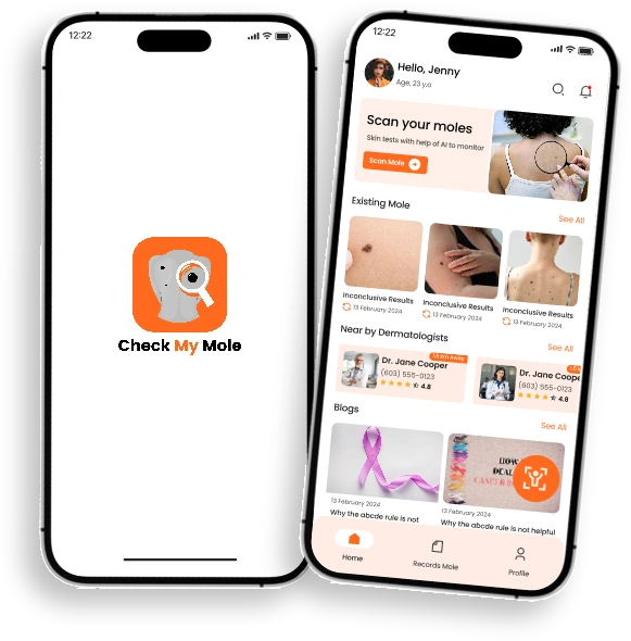 Check My Mole app screen