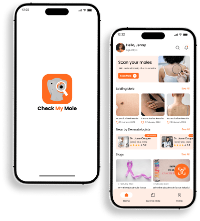 Check My Mole App Interface
